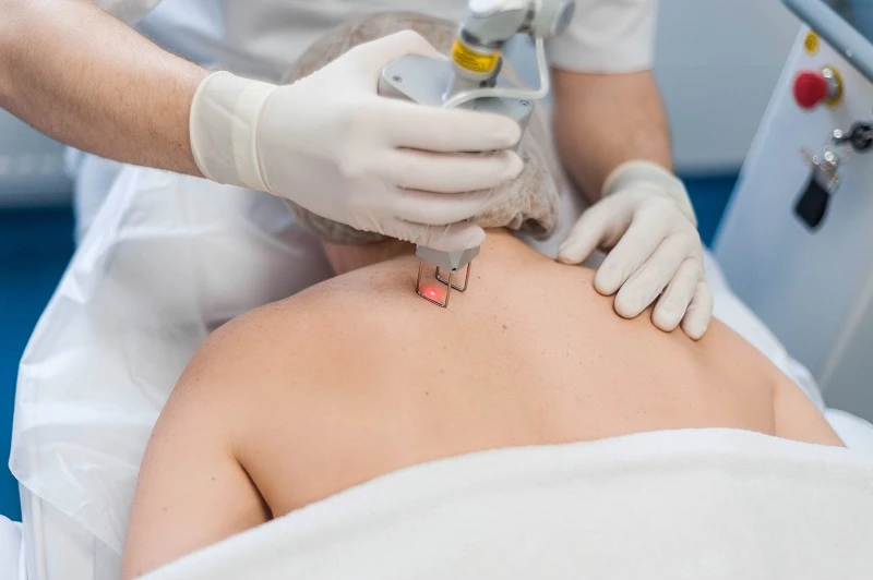 Exploring Cold Laser Treatment in Middle Tennessee: Benefits, Process & Results