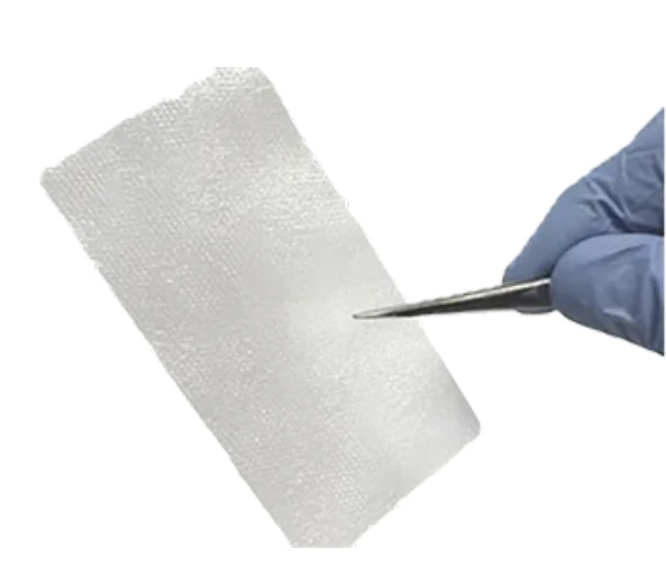 Transforming Wound Recovery with Amniotic Allografts: A New Era in Healing