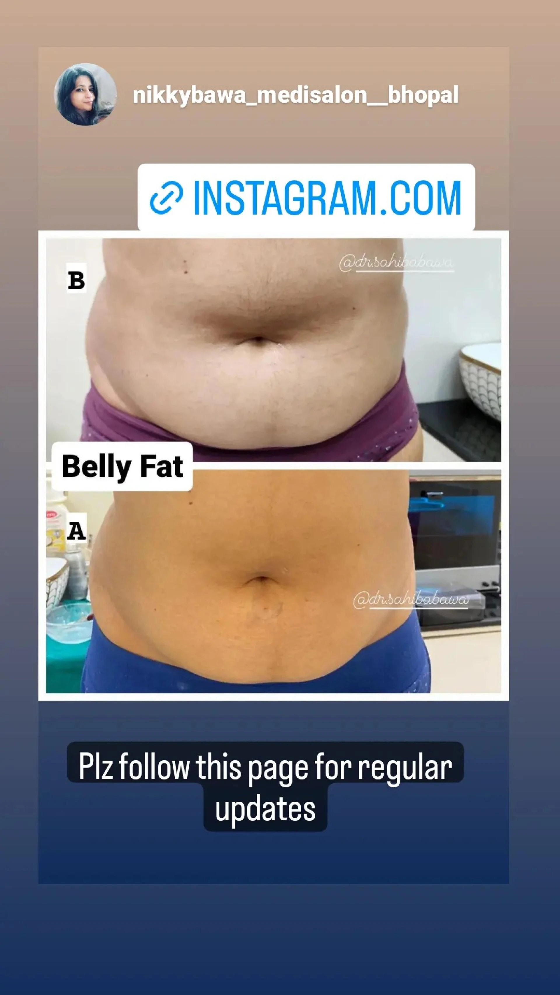 Struggling with Weight Loss in Bhopal? Here’s How an Aesthetic Salon Can Help