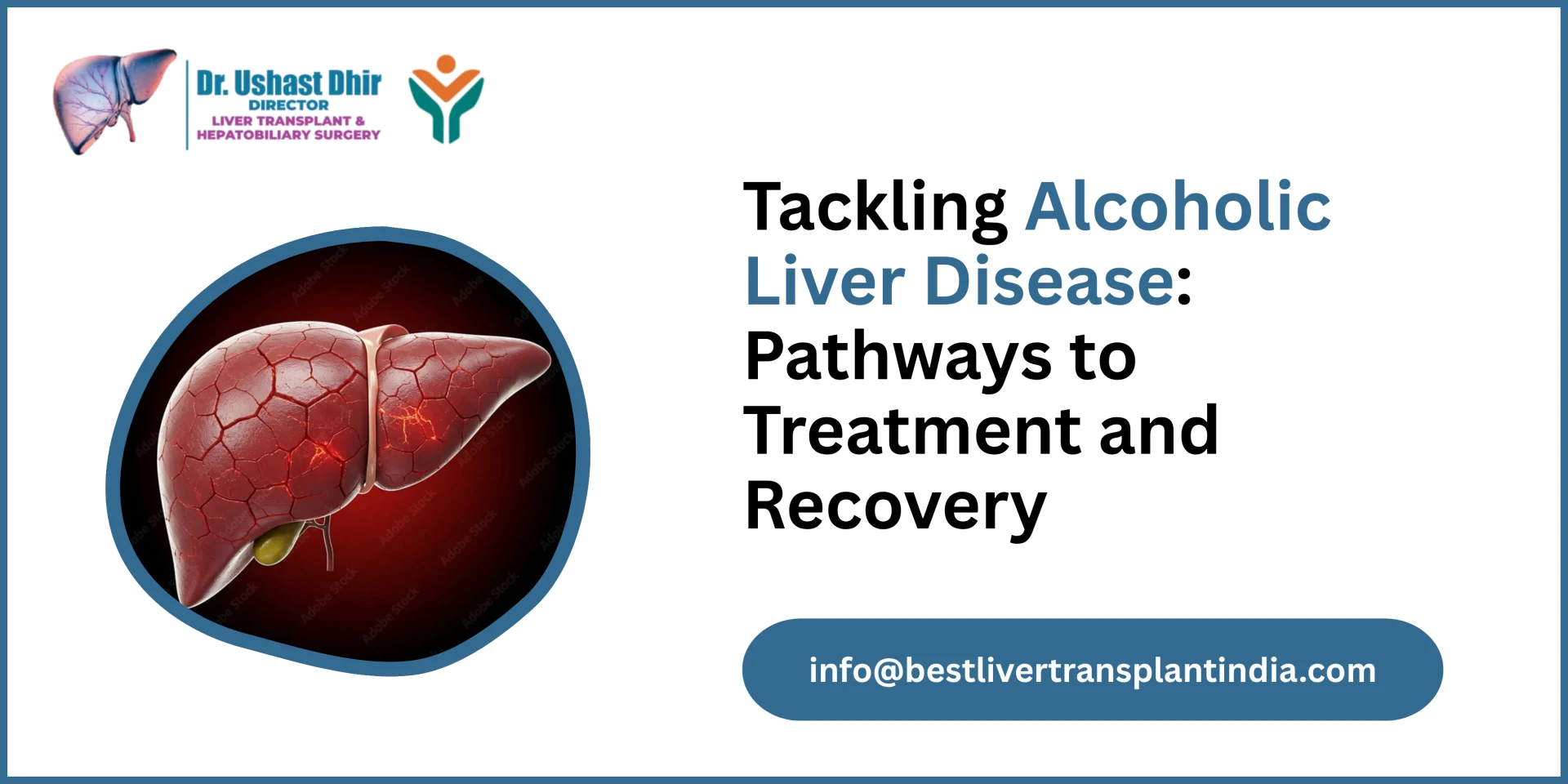 Tackling Alcoholic Liver Disease: Pathways to Treatment and Recovery
