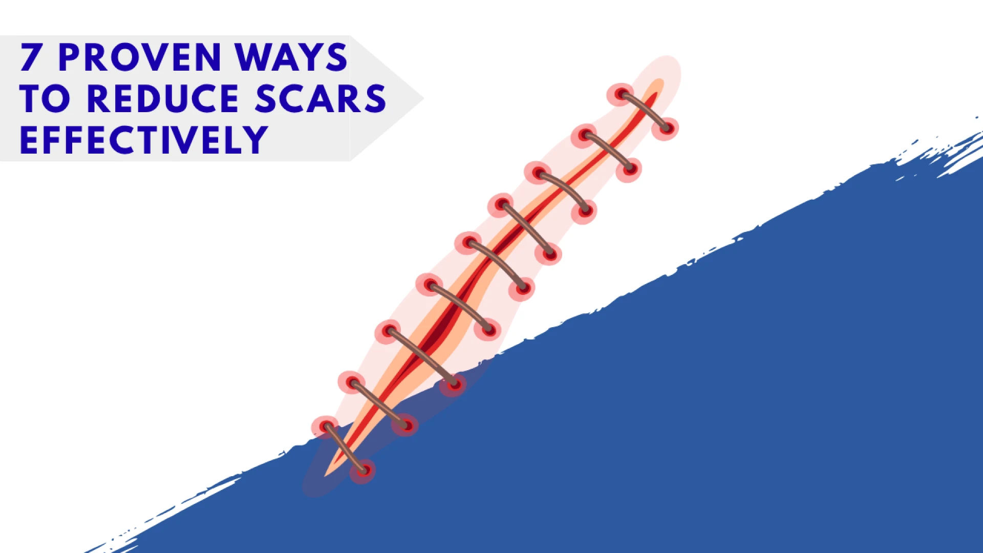 7 Proven Ways to Reduce Scars Effectively