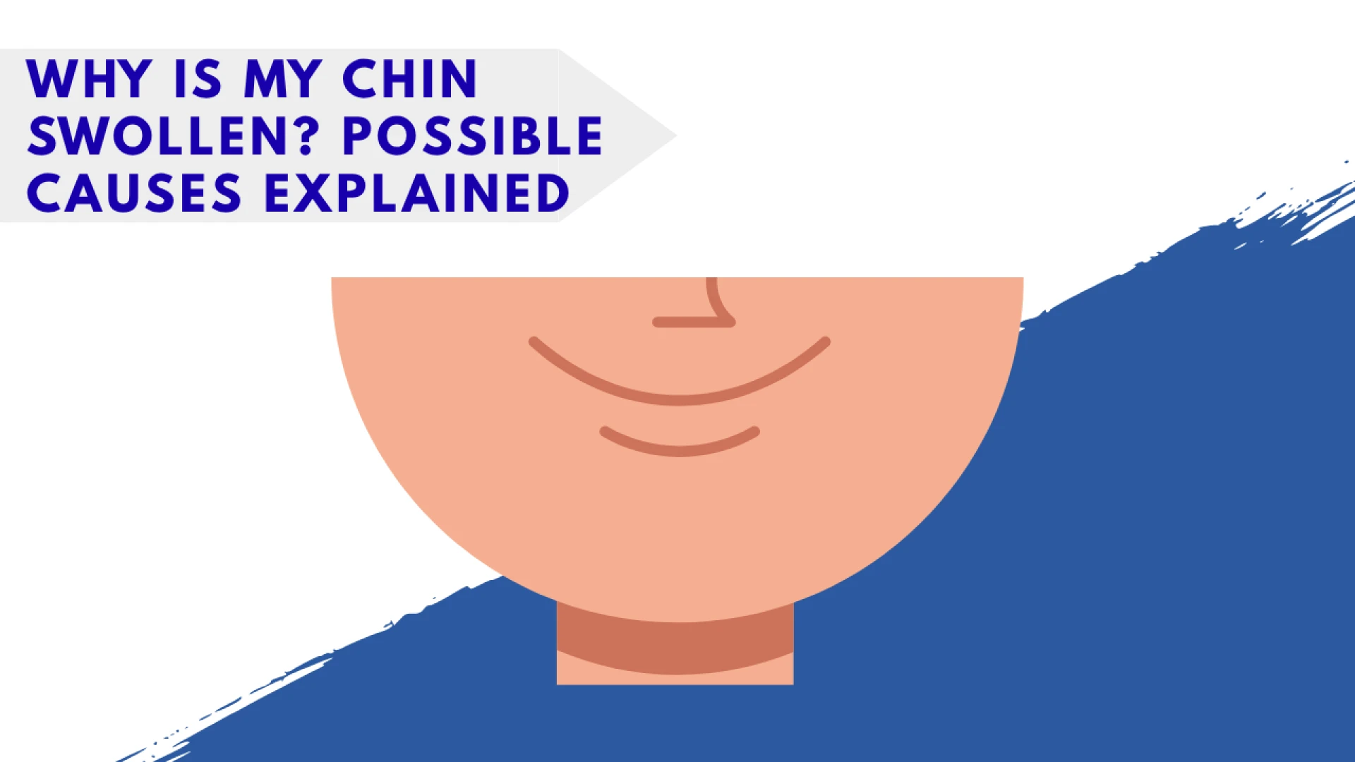 Why Is My Chin Swollen? Possible Causes Explained