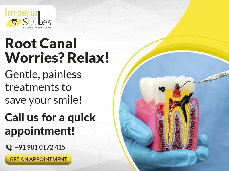 Scared of a Root Canal? Here Is Why You Should Not Be