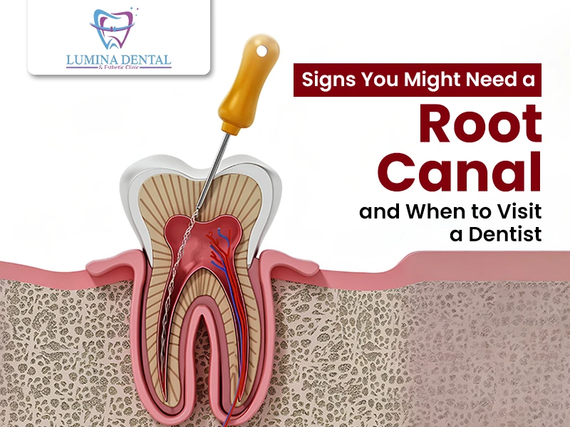 Saving Your Natural Tooth With Modern Precision Dentistry