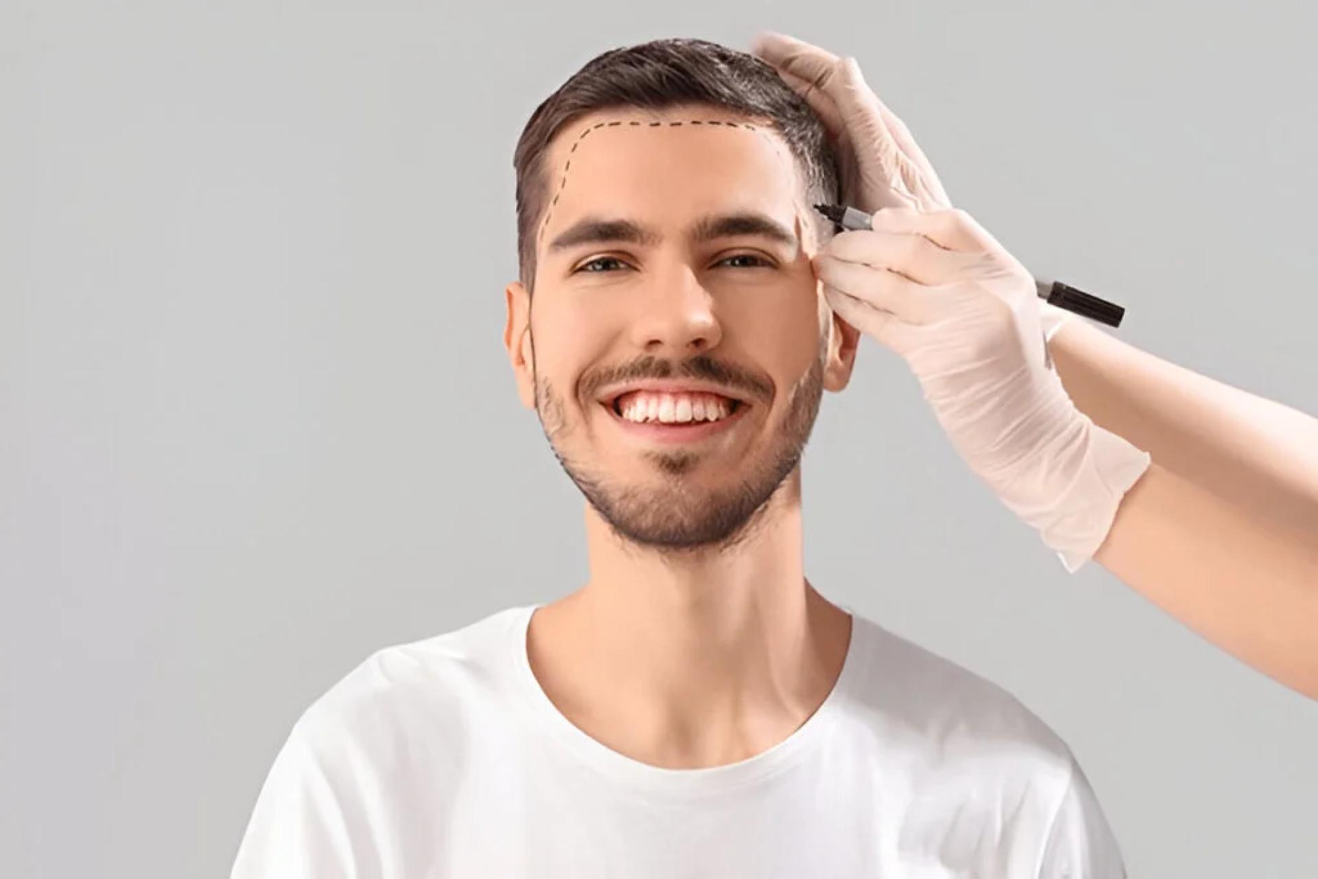 The Ultimate Guide to Hair Transplants in Delhi Costs Techniques Doctor Insights You Must Know