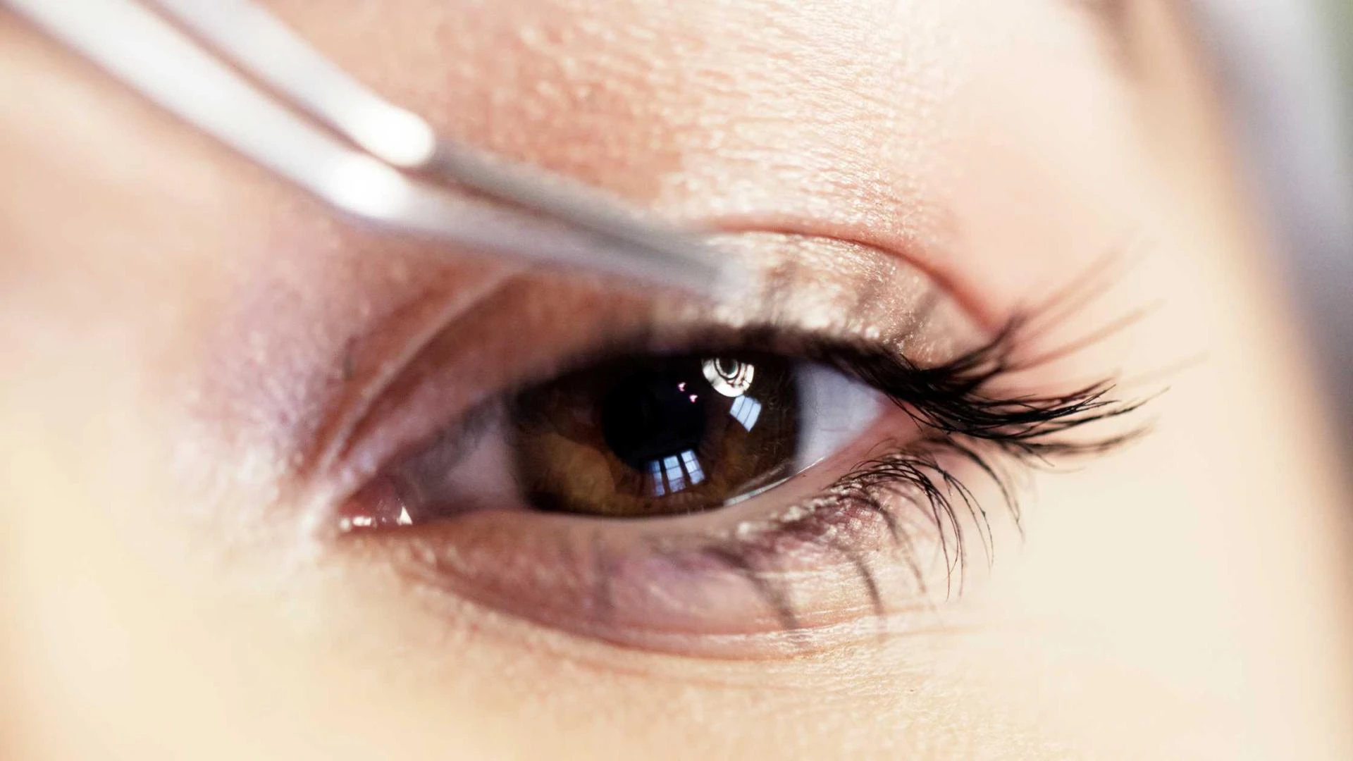 Affordable Dry Eye Clinic in Makhamali: Expert Care at Shree Ramkrishna Netralaya