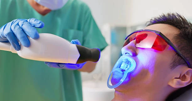 Teeth Whitening: A Simple Guide to a Brighter, More Confident Smile