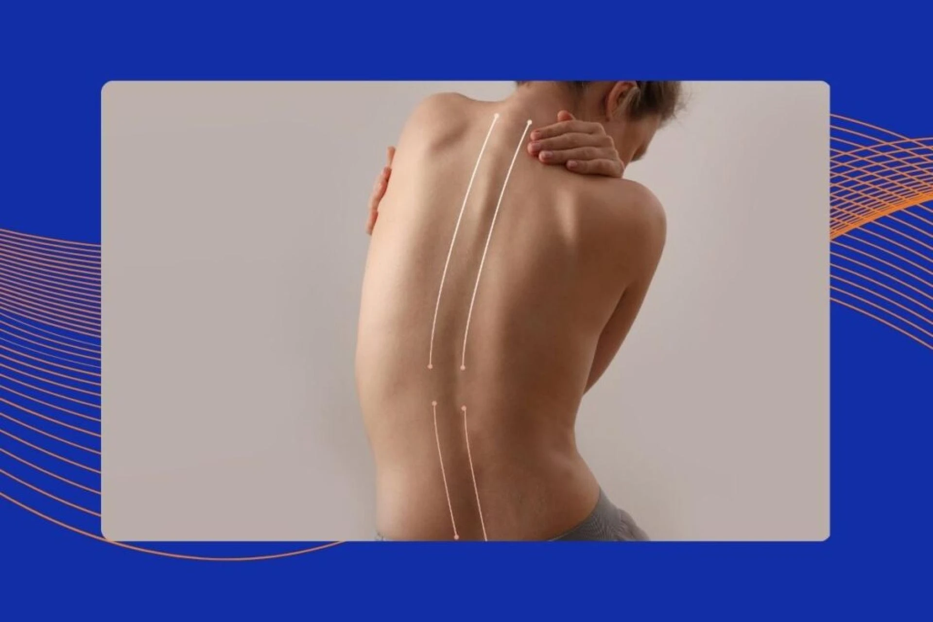 7 Ways to Prevent or Manage Scoliosis