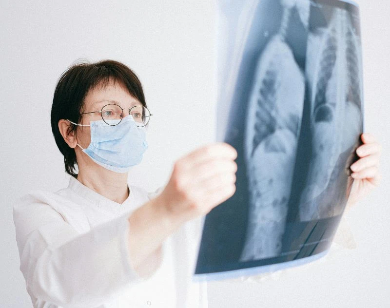 Key Symptoms Lung Cancer Stages Explained With Early Warning Signs