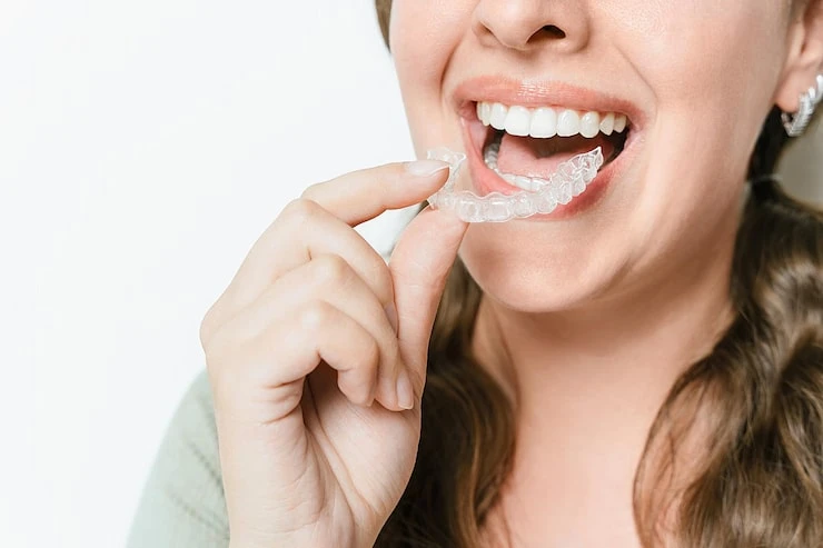 How to Care for Your Invisalign Aligners Properly for Faster, Better Results