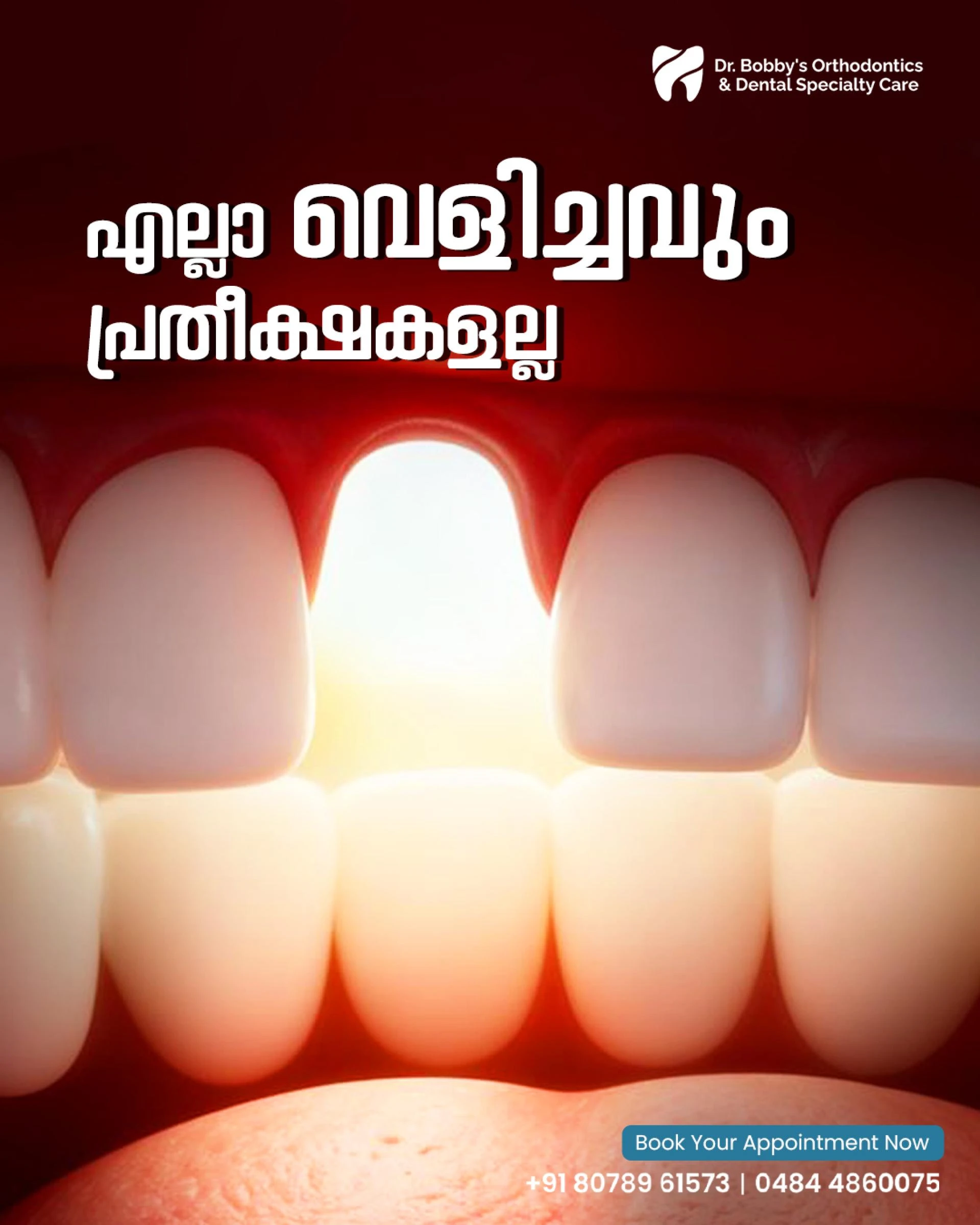 Teeth Whitening and Teeth Bleaching: Everything You Need to Know