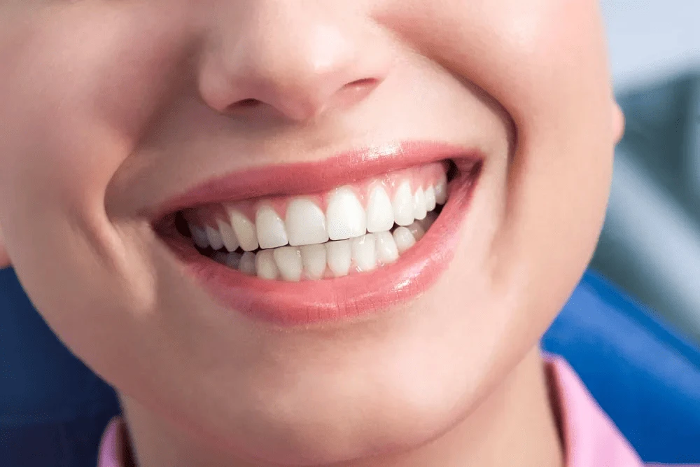 Why Perth Dental Implants Are the Gold Standard for Tooth Loss