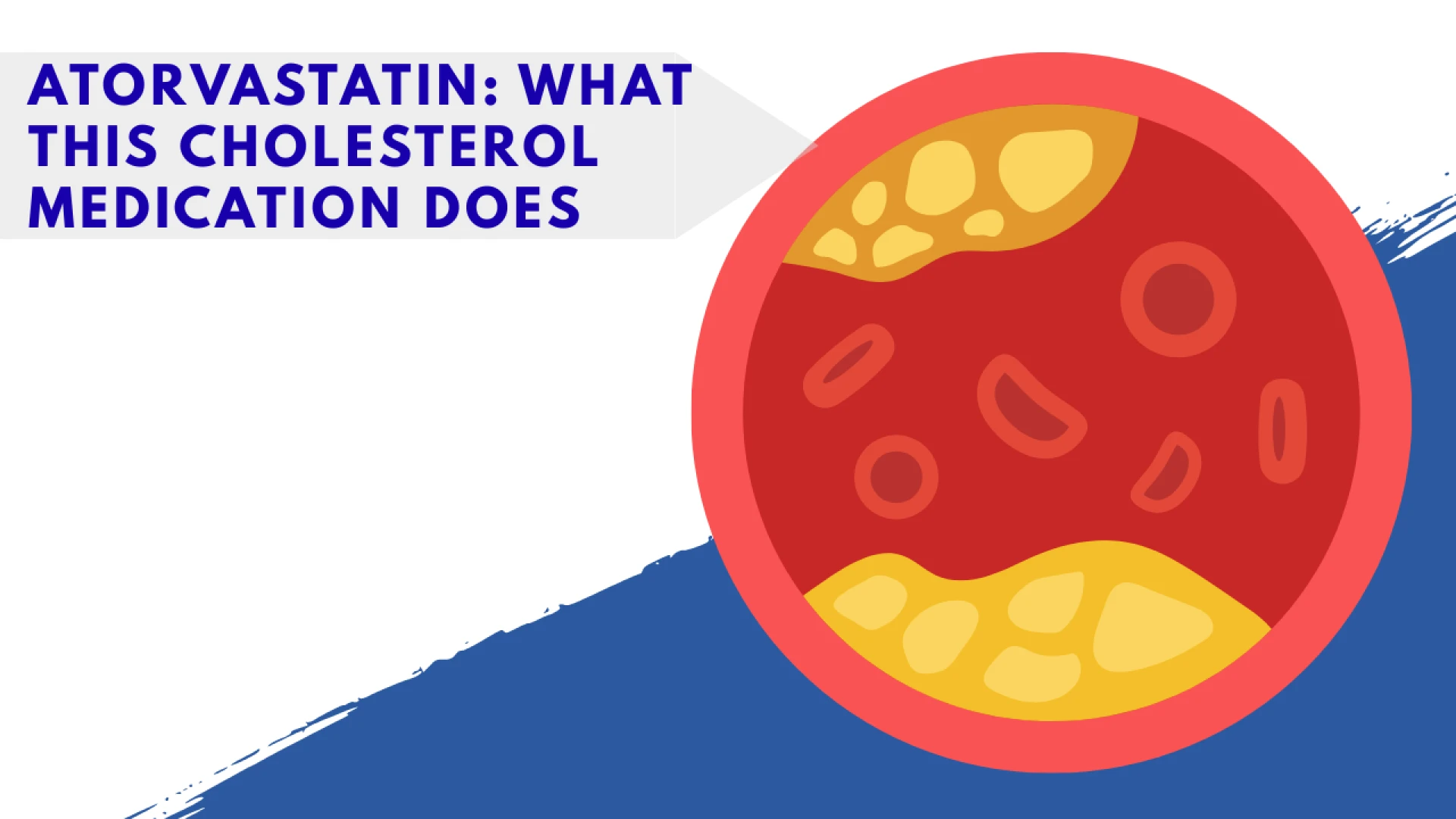 Atorvastatin: What This Cholesterol Medication Does