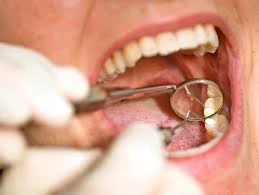 Pediatric Dental Care Services in Leading Dental Clinics in Delhi