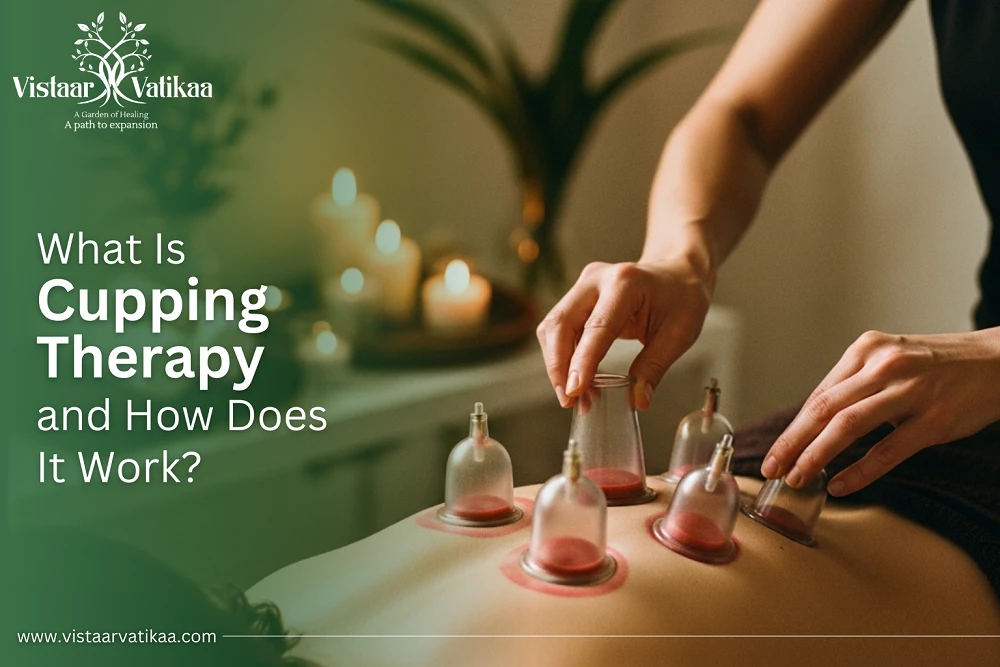 What Is Cupping Therapy and How Does It Work?