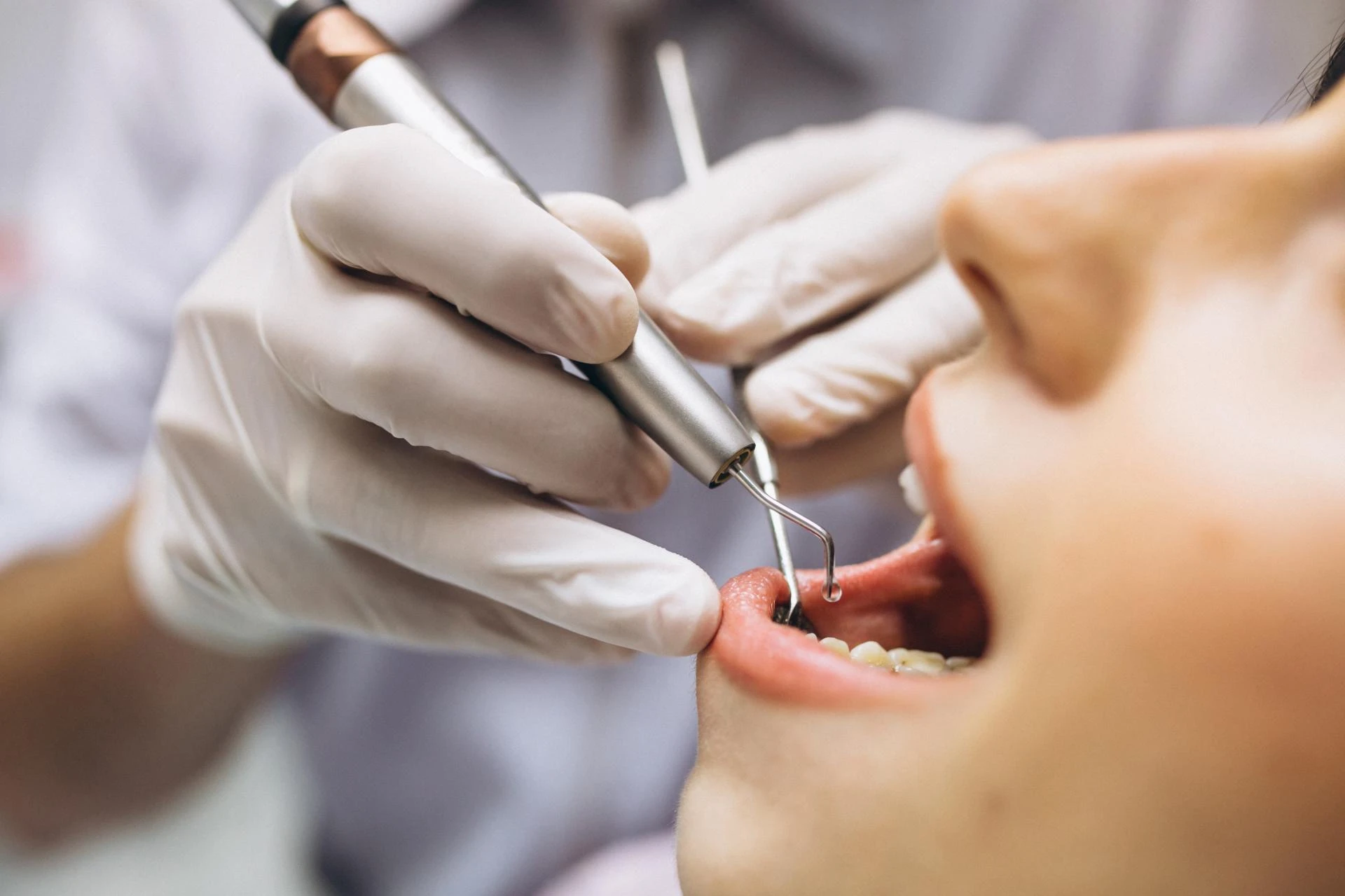 Dentist Close By Me – Complete Guide to Local Dental Care for Every Need