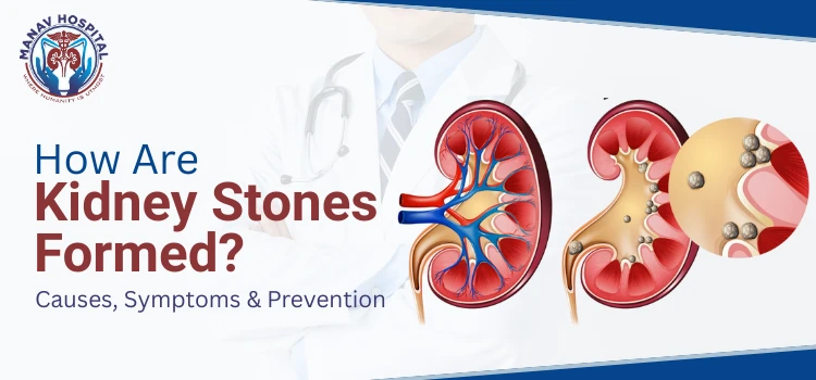 How Are Kidney Stones Formed? A Simple Medical Explanation