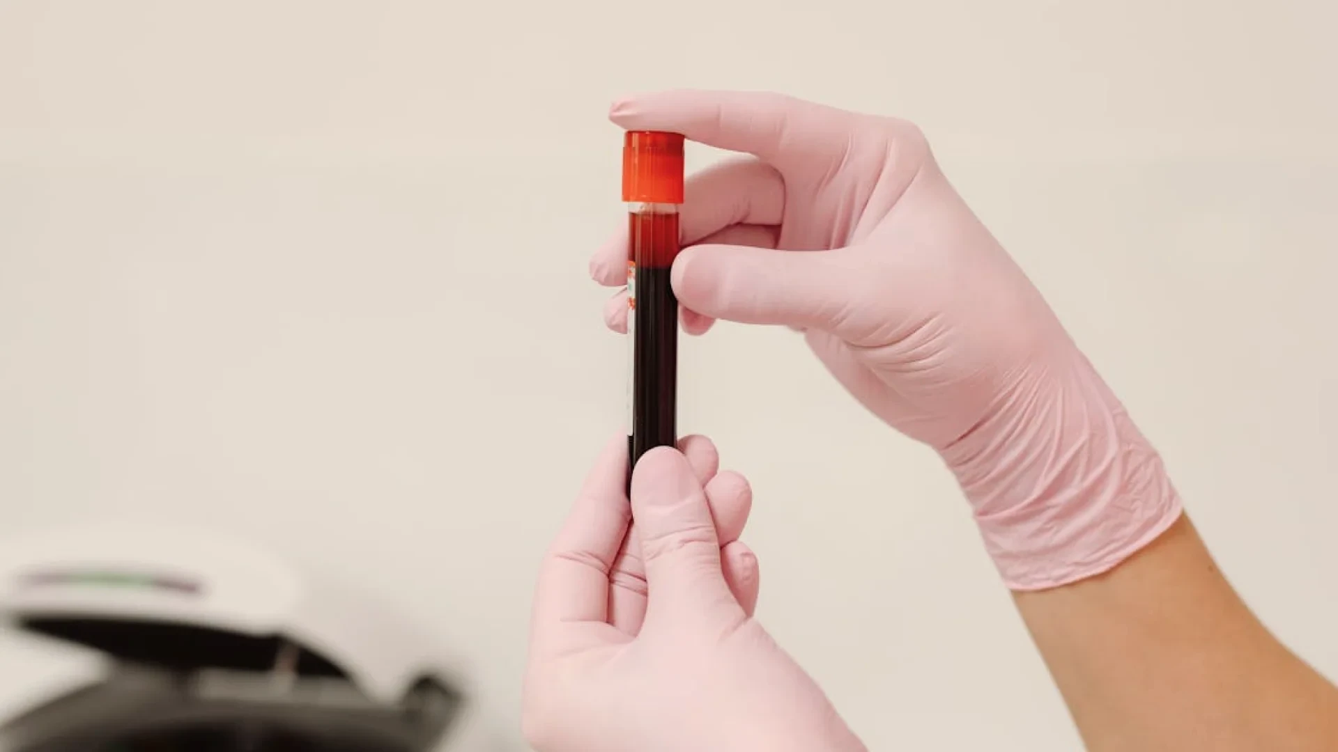 Complete Guide to Female Hormone Tests: Timing & Coverage