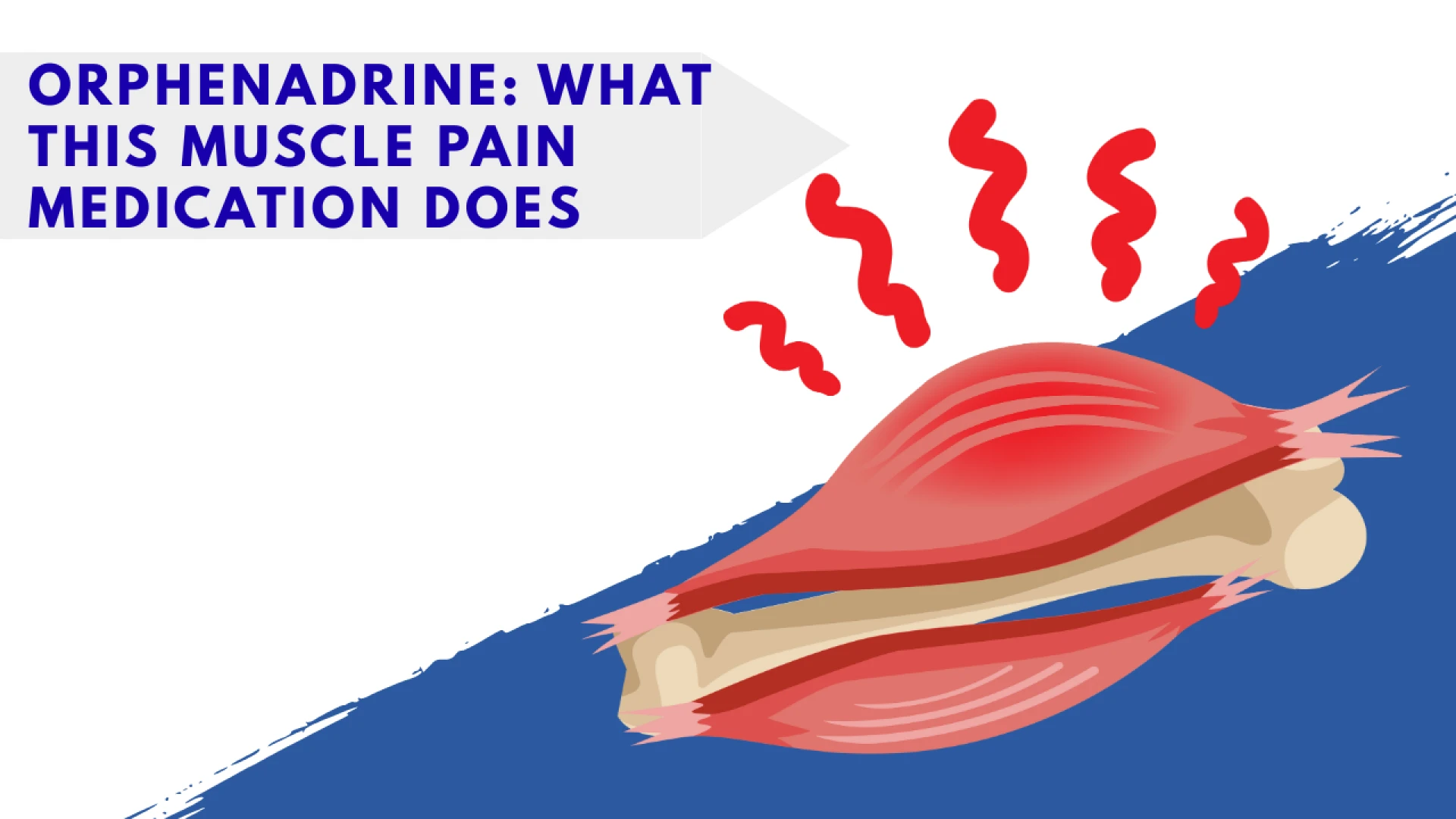 Orphenadrine: What This Muscle Pain Medication Does