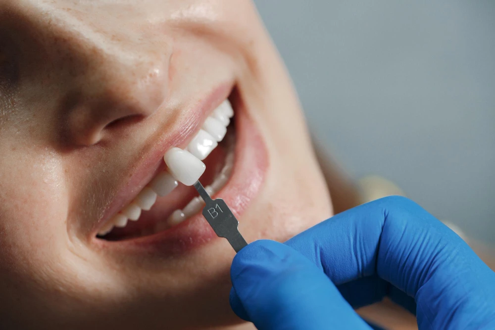 Which Hyderabad Clinics Offer Reliable Dental Implants?