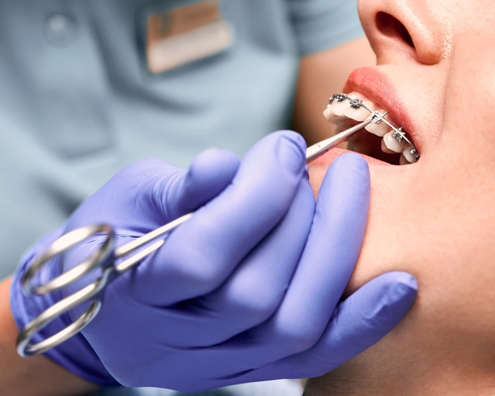 How Orthodontics Improves Oral Health and Smiles for Oakville Patients