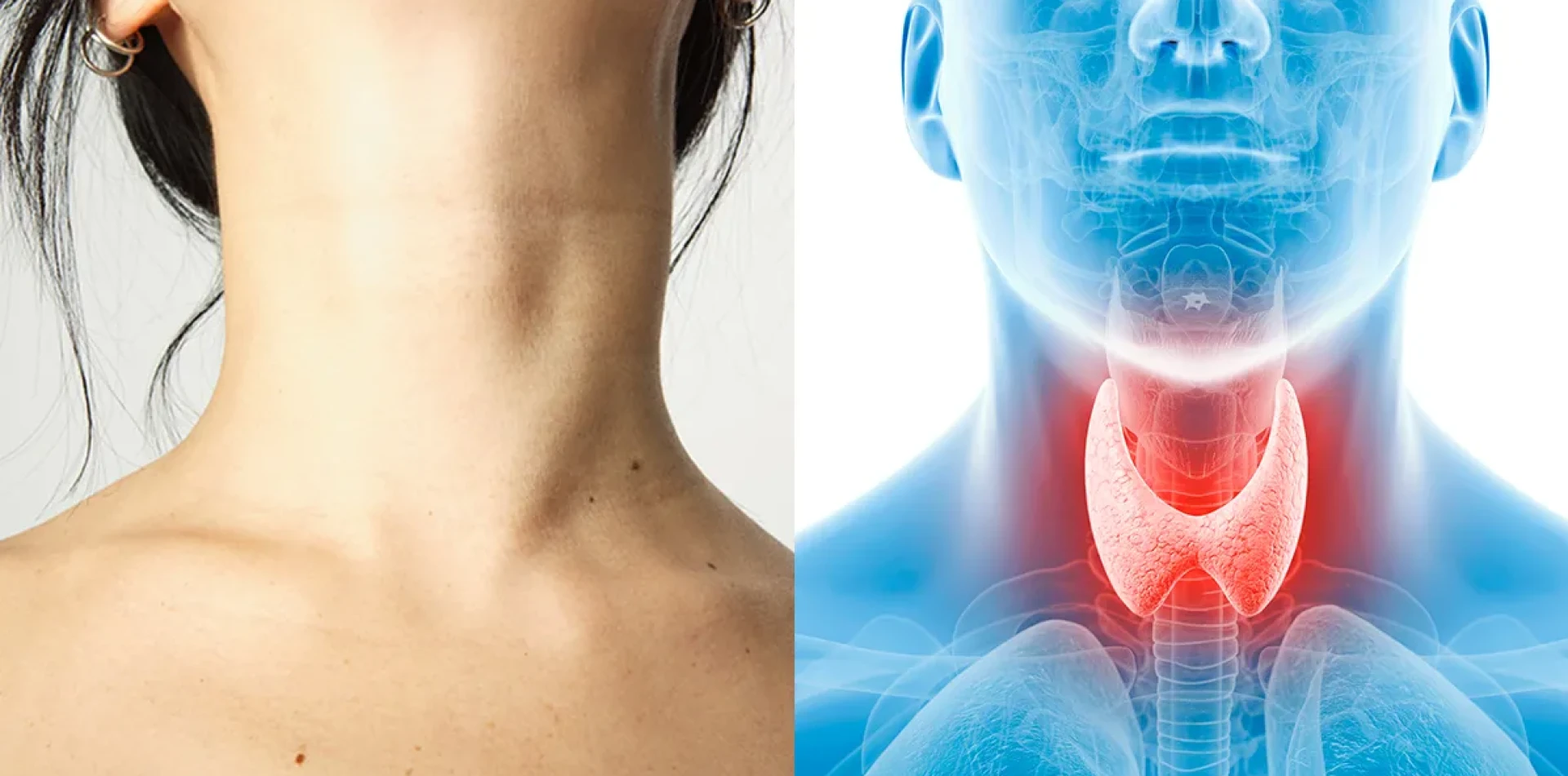 Early Signs Your Thyroid Needs Root-Cause Intervention