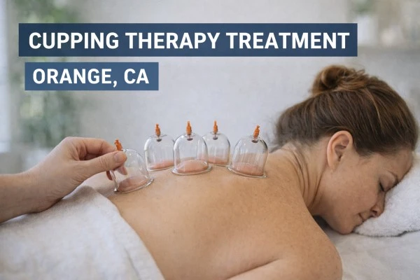 Cupping Therapy Treatment in Orange, CA: Natural Relief for Pain