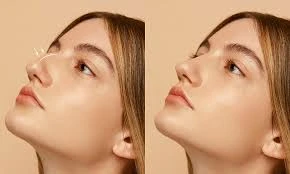 Monica General Hospital Plastic Surgery: Procedures, Safety Standards, and Patient Expectations