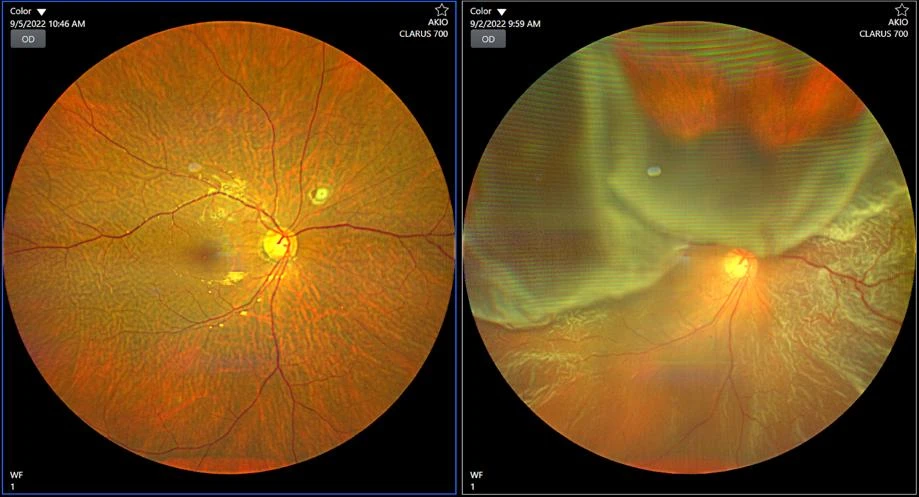 Your Guide to Finding the Right Retina Specialist in Delhi