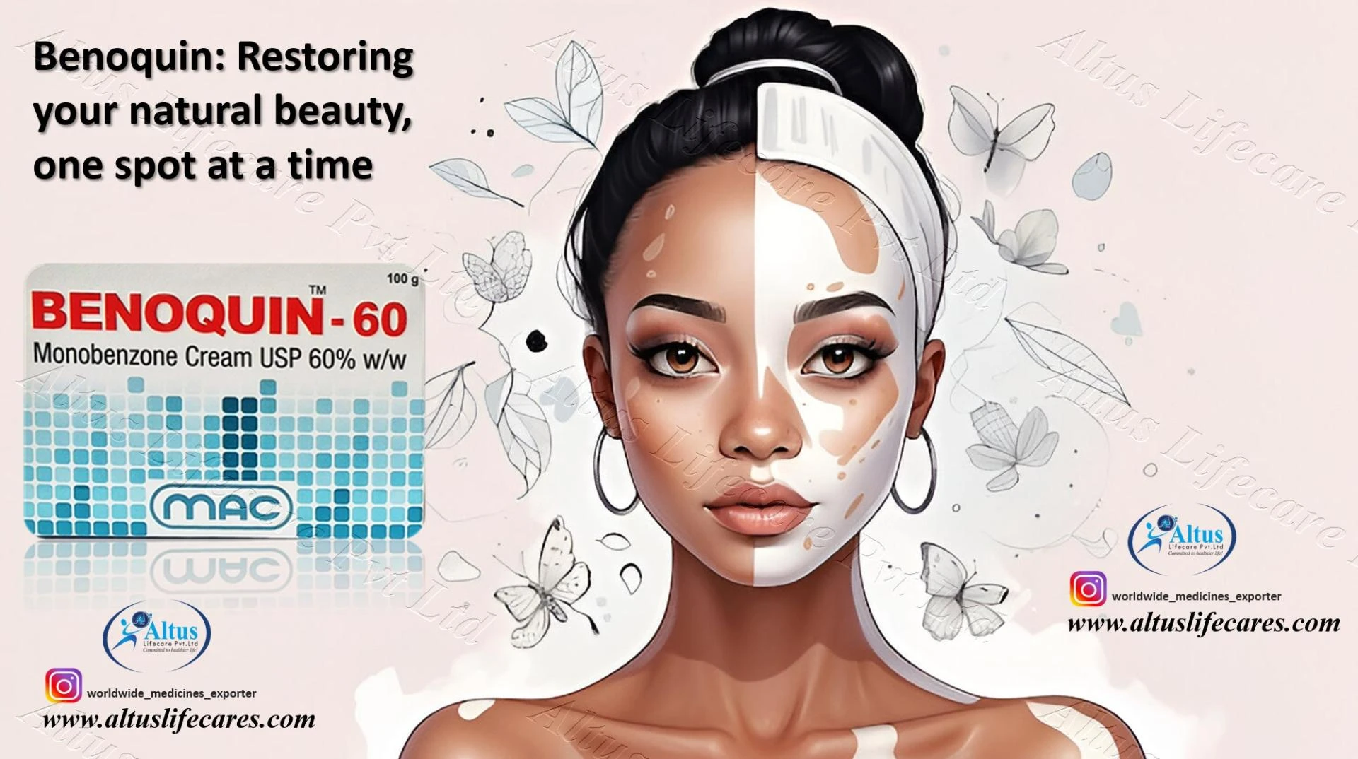 Benoquin 60% Cream – Smooth, Repigmented Skin in Weeks