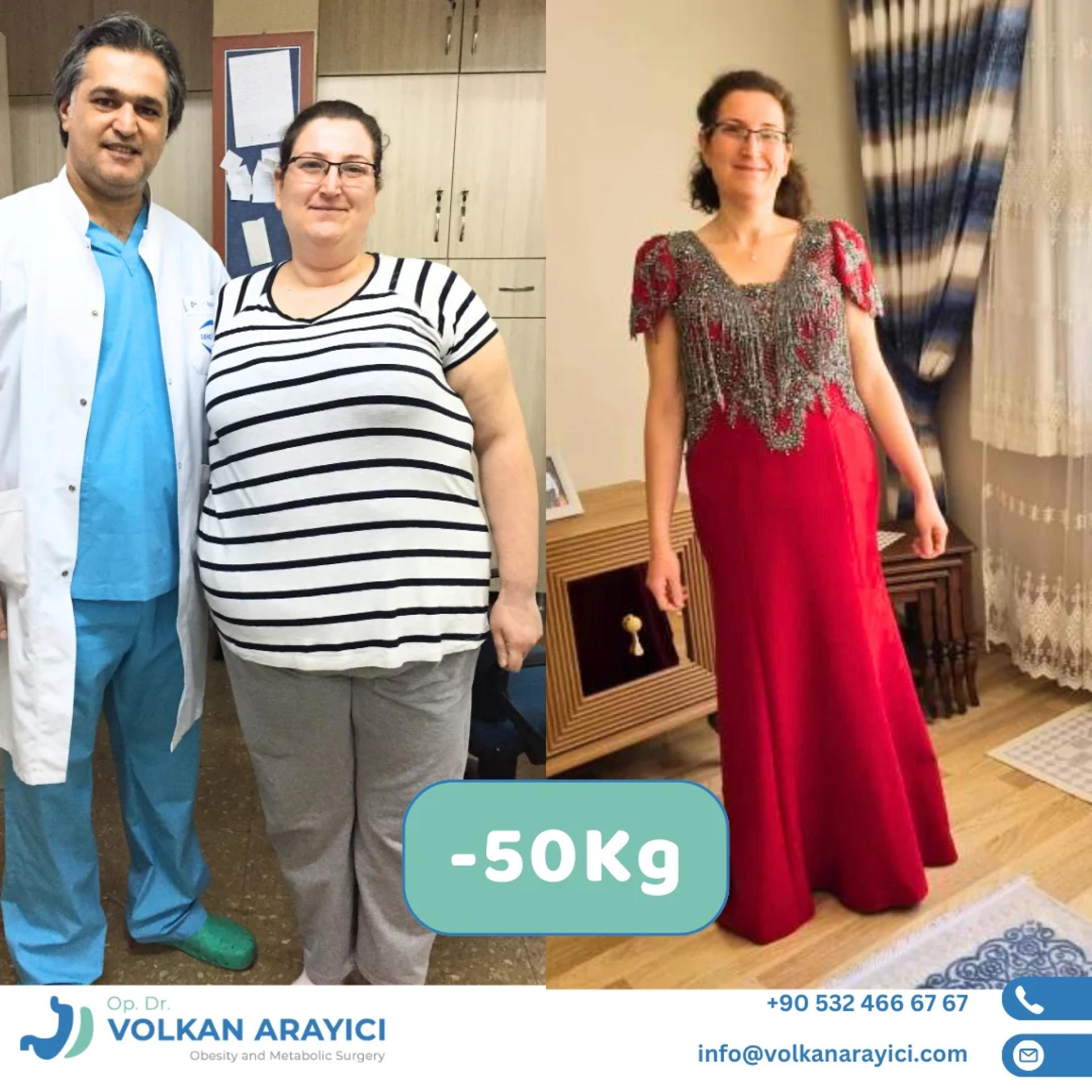 Magenbypass Türkei: Für wen ist diese OP geeignet und welche Vorteile bietet sie?