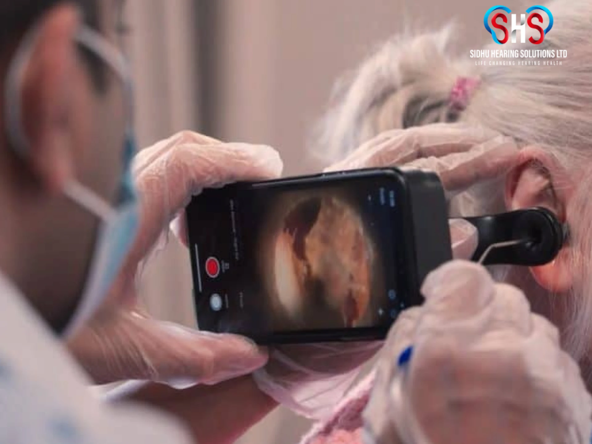 Mobile Earwax Removal – Safe, Convenient Hearing Care at Your Doorstep