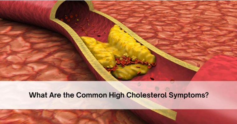 What Are the Common High Cholesterol Symptoms?