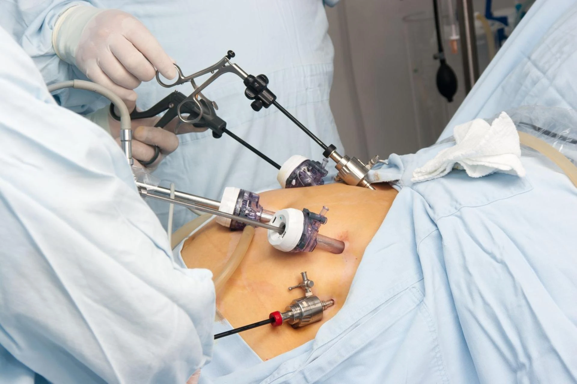 Robotic Bariatric Surgery: How Technology Is Transforming Weight Loss Procedures