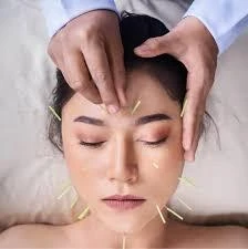 Complementary Therapies for Facial Pain Conditions