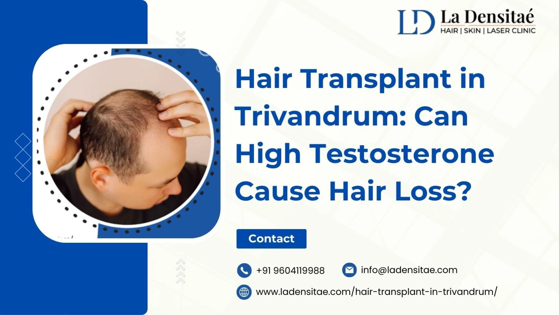Hair Transplant in Trivandrum: Can High Testosterone Cause Hair Loss?