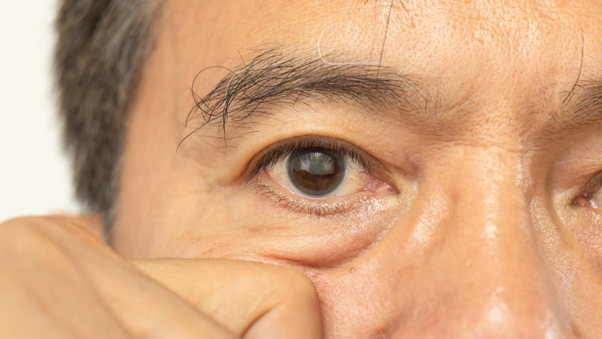 Revolutionizing Vision: How SCHWIND ATOS in Mumbai is Changing the Game for Laser Eye Treatments