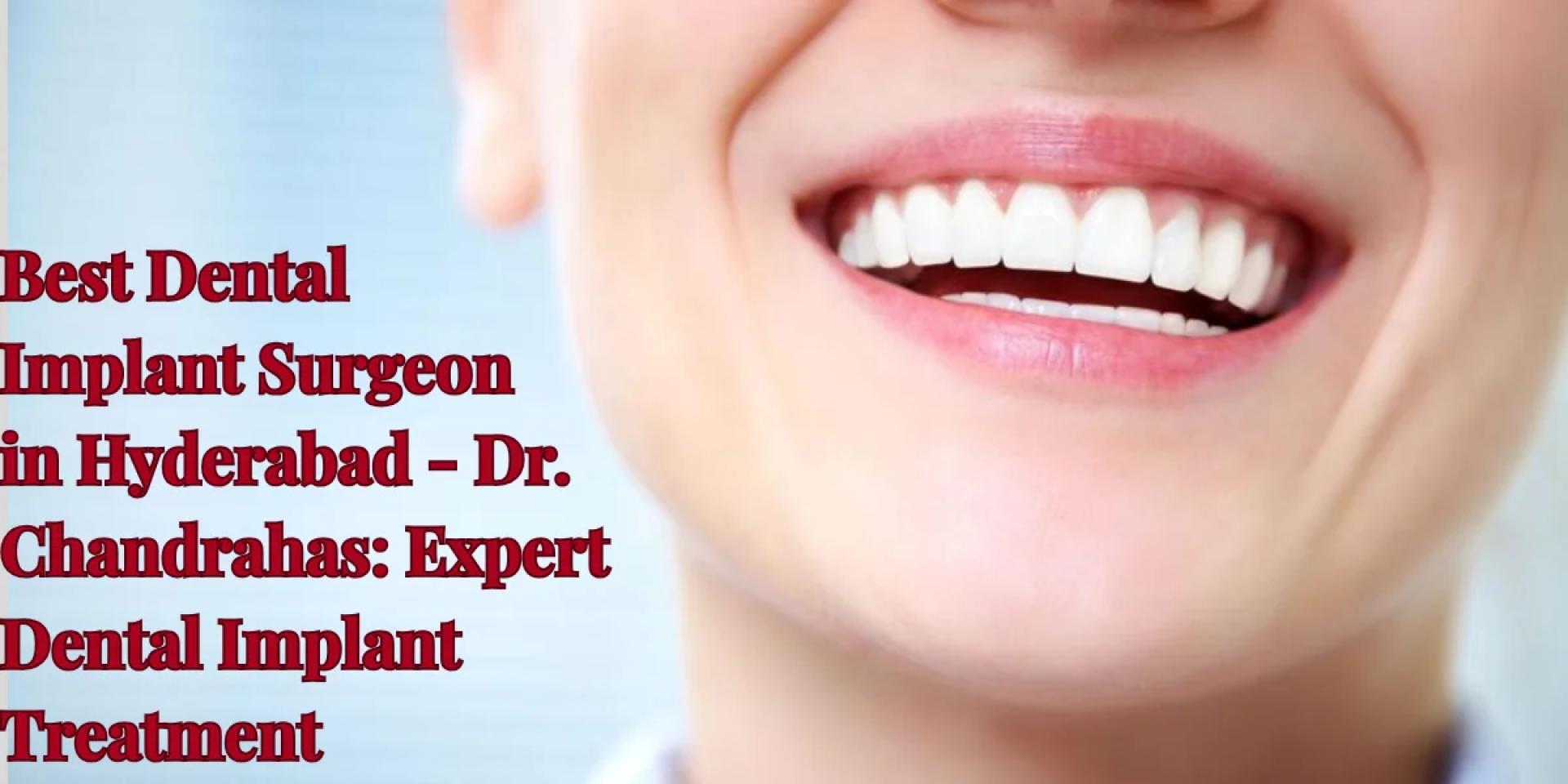 Best Dental Implant Surgeon in Hyderabad – Dr. Chandrahas: Expert Dental Implant Treatment