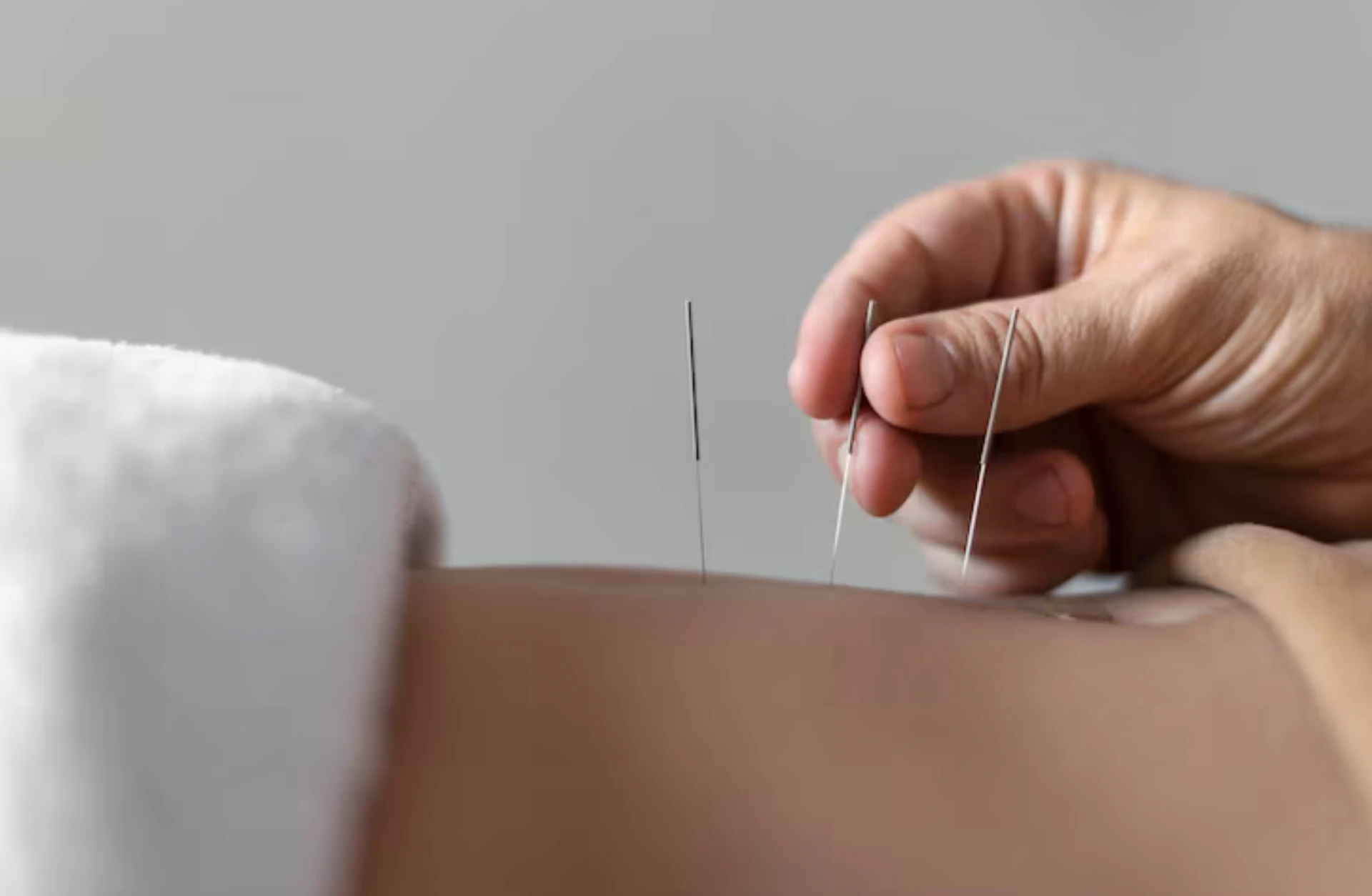 Feeling Constantly Tired? How Acupuncture Massage Restores Energy