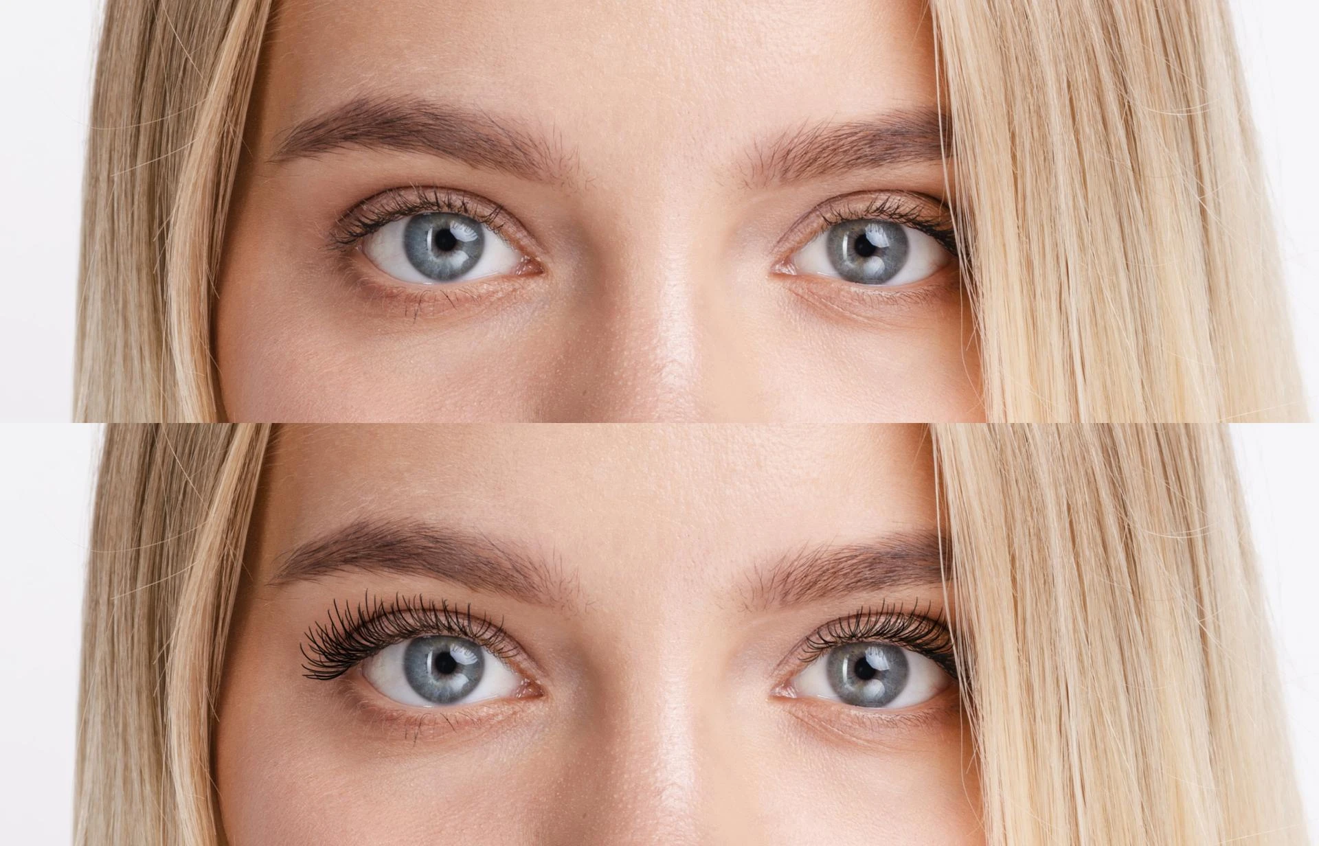 When Are Eyebrow Botox Before and After Results Most Noticeable?
