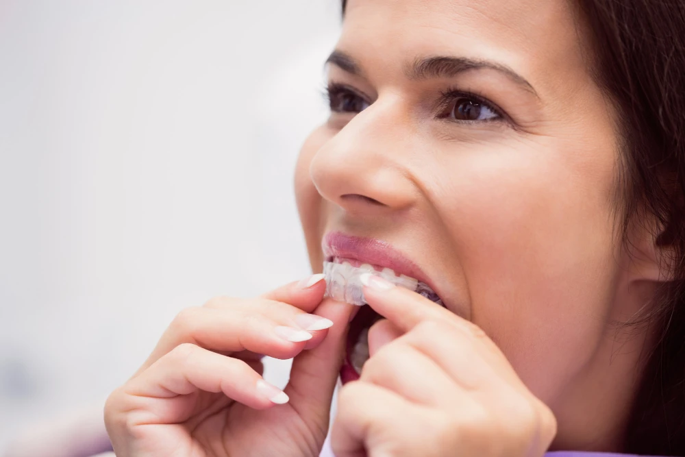 Clear Aligner Treatment in RR Nagar, Bangalore: What You Should Know?