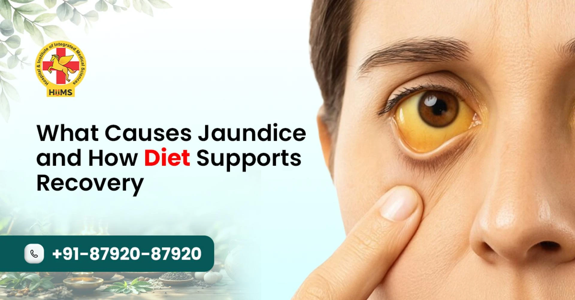 What Leads to Jaundice and How the Right Diet Aids Recovery