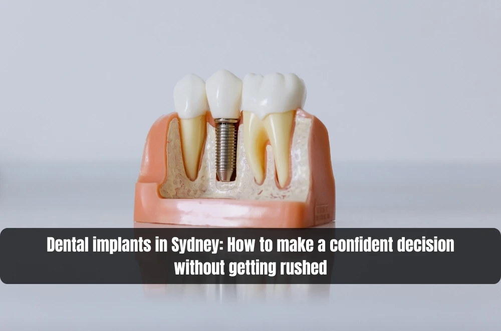 Dental implants in Sydney: How to make a confident decision without getting rushed