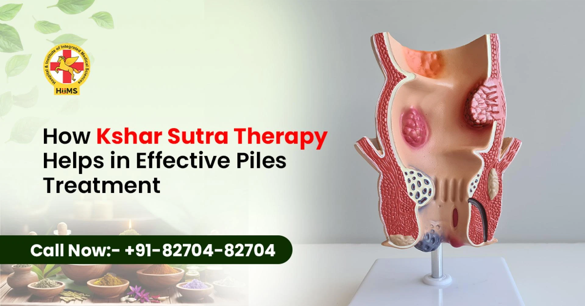 Kshar Sutra Therapy for Piles: A Safe and Natural Ayurvedic Treatment