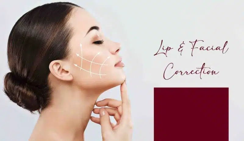 Smile Enhancement with Lip Lengthening Treatment in Hyderabad