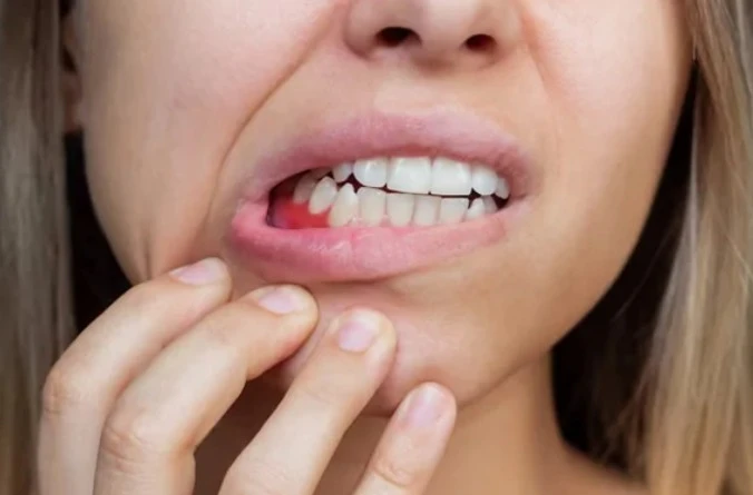 Why Do My Gums Bleed When I Brush ?
