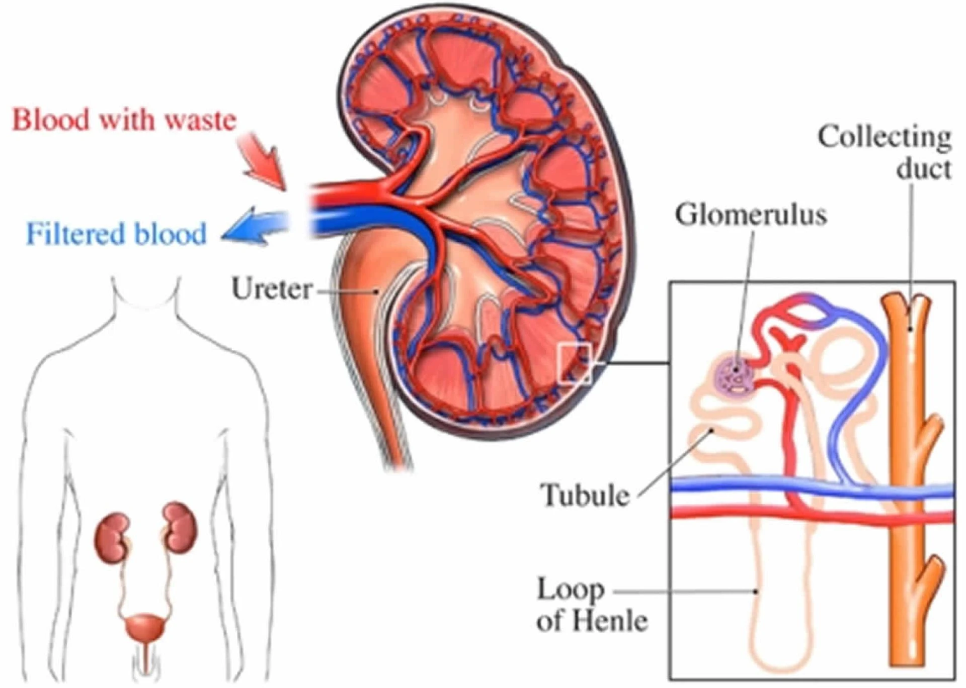 Recognizing and Managing Rare Kidney Conditions: Symptoms, Genes, and Causes