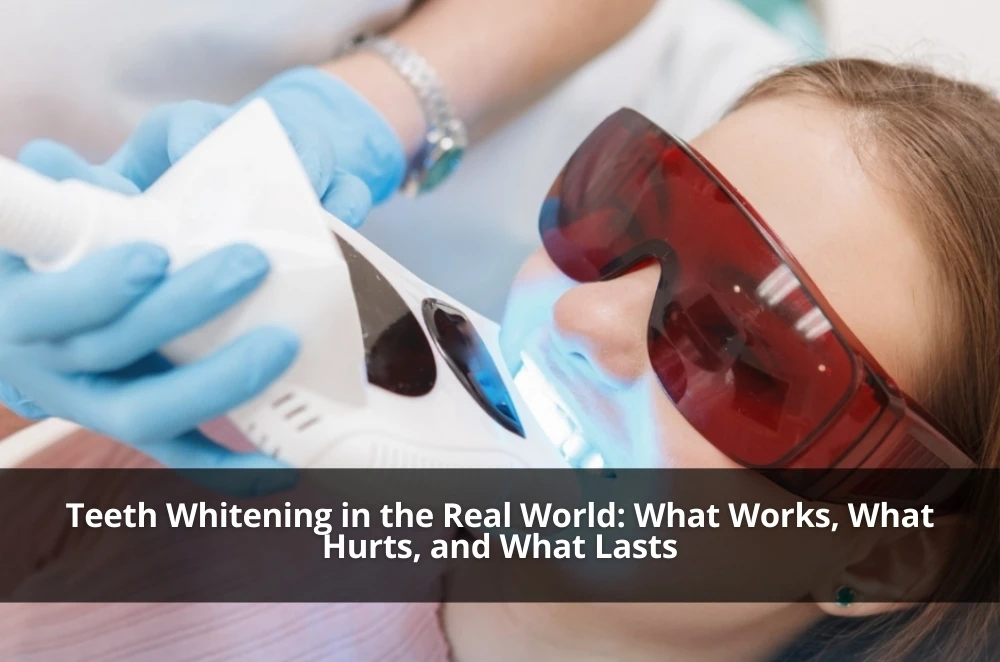Teeth Whitening in the Real World: What Works, What Hurts, and What Lasts