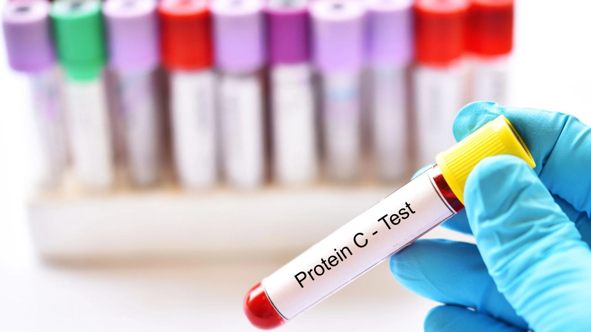 Foods That Fight Chronic Low-Level Swelling