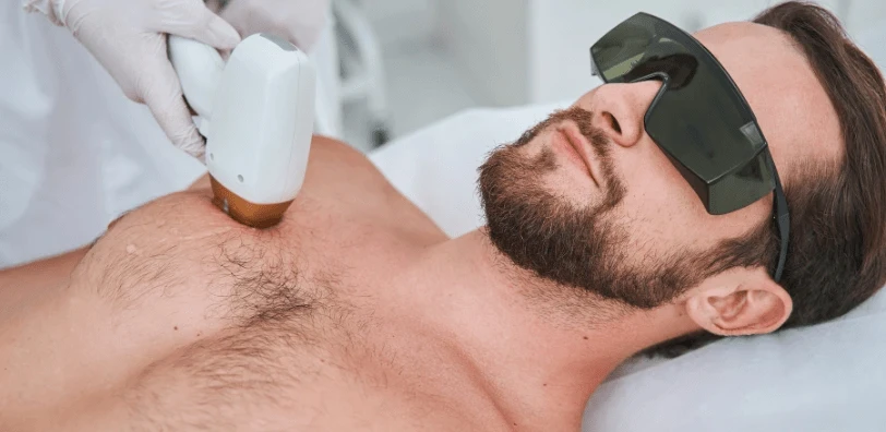 Is At-Home Treatment as Effective as Professional Toronto Laser Hair Removal?